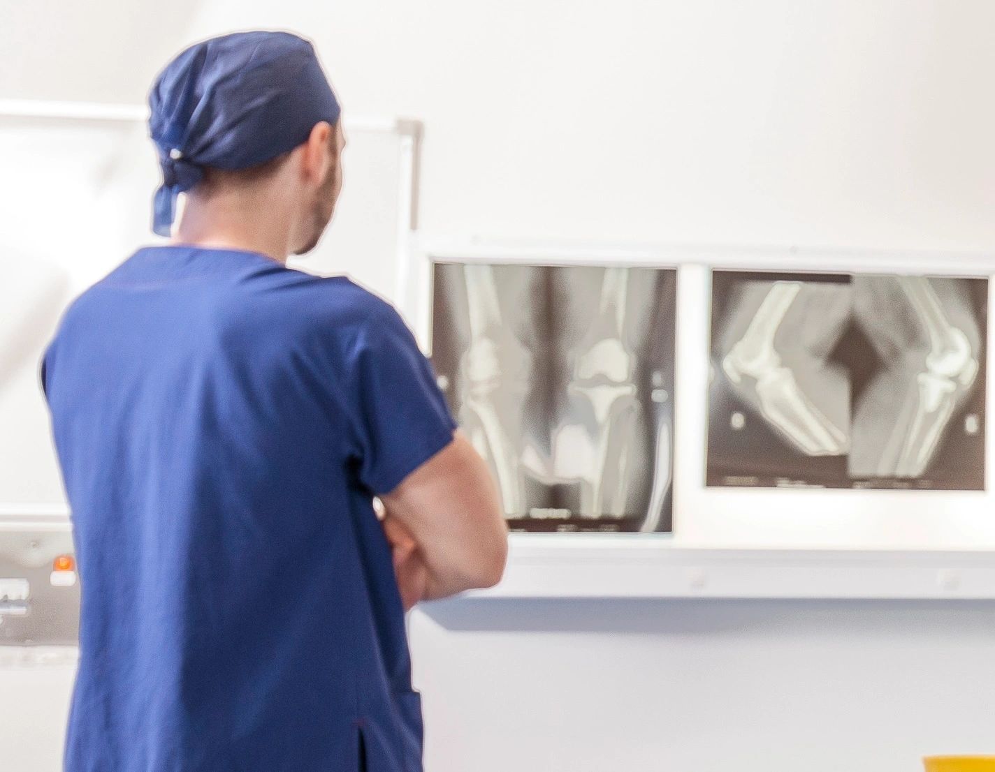 Two-stage revision ACL reconstruction: Dr Alexey Borshch reviewing knee X-rays to check the old tunnels and bone graft healing