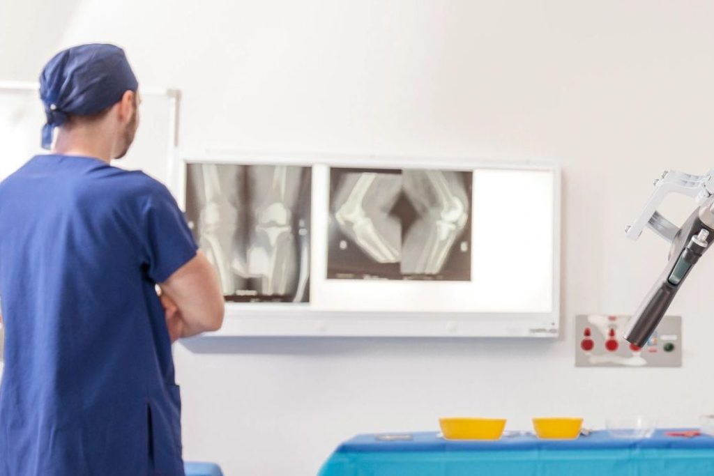 Dr. Alexey Borshch planning robotic knee replacement