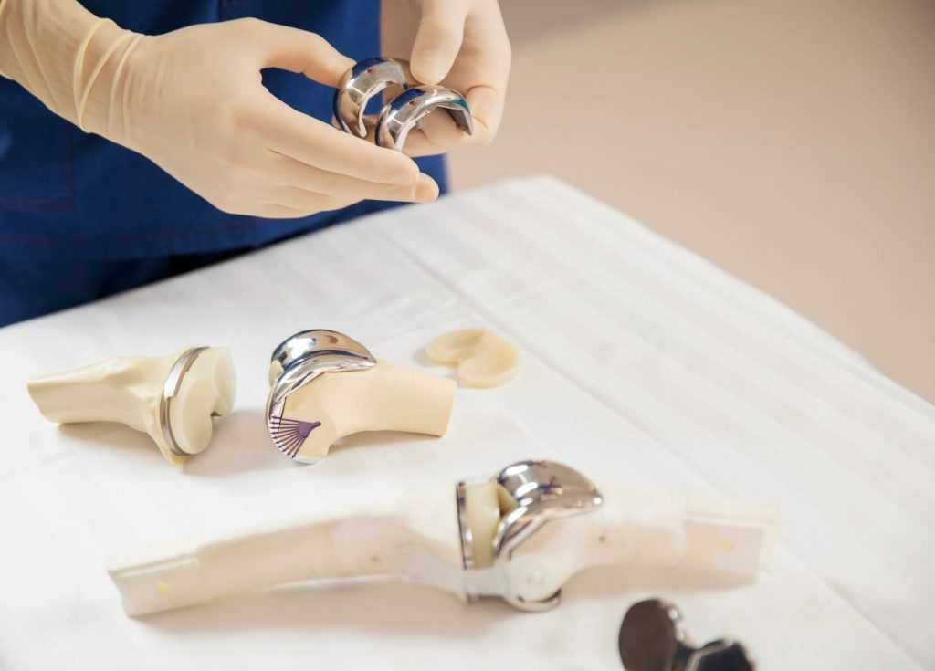 Knee replacement components